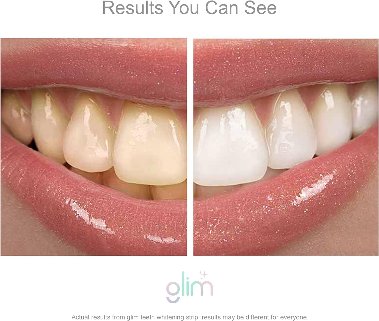 Glim Teeth Whitening Strips